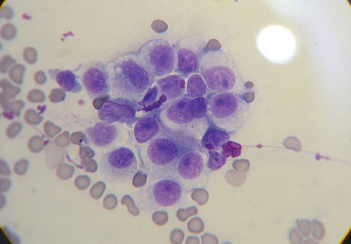 Leptospirosis