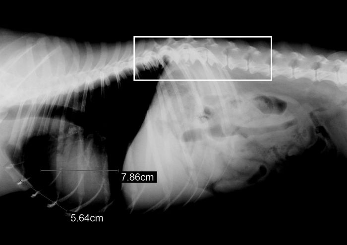 Discoespondilitis