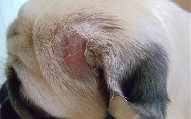 Dermatofitosis – Tiña